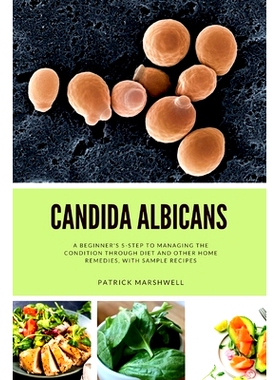 预订 Candida Albicans: A Beginner’s 5-Step to Managing the Condition Through Diet and Other Home Remedies, With Sample