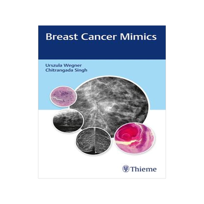 [预订]Breast Cancer Mimics 9789388257947