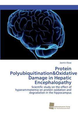 [预订]Protein Polyubiquitination&Oxidative Damage in Hepatic Encephalopathy 9783838152950