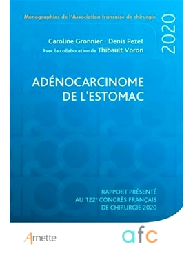 预订 Adénocarcinome de l’estomac : rapport présenté au 122e Congrès français de chirurgie : Paris, 2-4 septembre 2