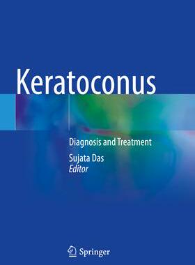 [预订]Keratoconus 9789811942648