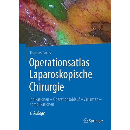 Indikationen - Operationsablauf - Varian