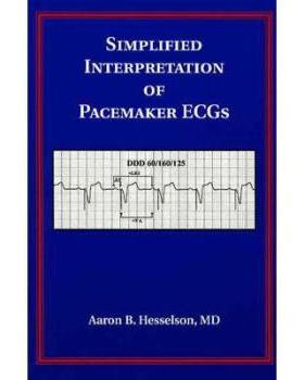 【预订】Simplified Interpretation Of Pacemaker Ecgs 9781405103725