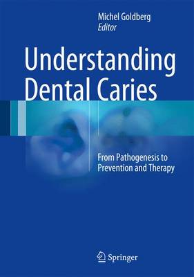 【预订】Understanding Dental Caries