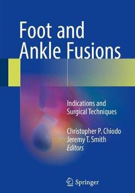 【预订】Foot and Ankle Fusions