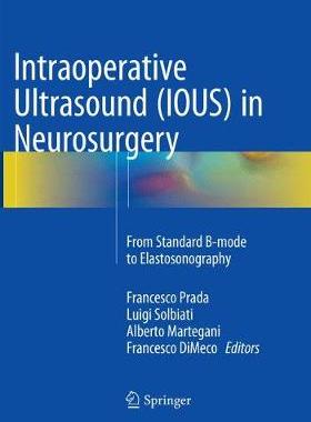 预订 Intraoperative Ultrasound (IOUS) in Neurosurgery