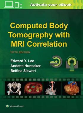 【预订】Computed Body Tomography with MRI Correlation