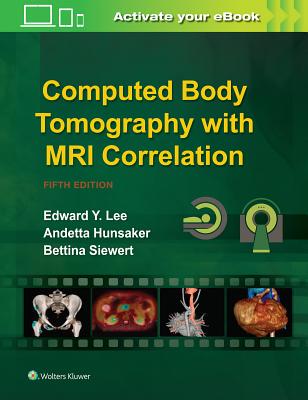 【预订】Computed Body Tomography with MRI Correlation