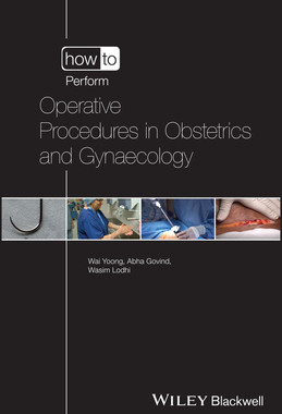 【预订】How To Perform Operative Procedures In Obstetrics And Gynaecology