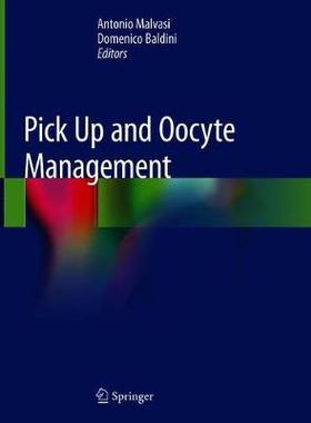 预订 Pick Up and Oocyte Management