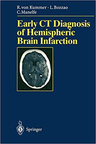 【预订】Early CT Diagnosis of Hemispheric Brain Infarction