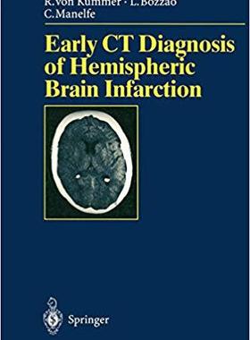 【预订】Early CT Diagnosis of Hemispheric Brain Infarction