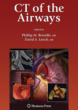 【预订】CT of the Airways