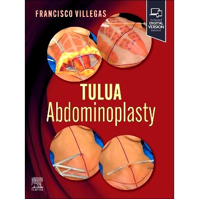 预订 TULUA Abdominoplasty: Transverse Plication Technique: 9780443118821