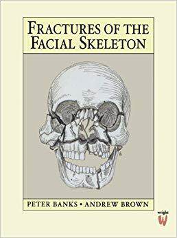 【预售】Fractures of the Facial Skeleton