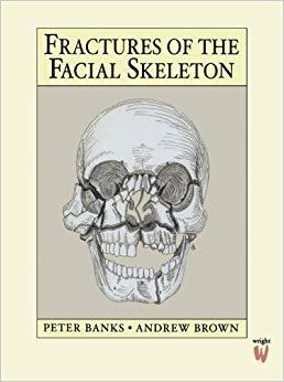 【预售】Fractures of the Facial Skeleton