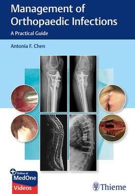 [预订]Management of Orthopaedic Infections: A Practical Guide 9781684201334