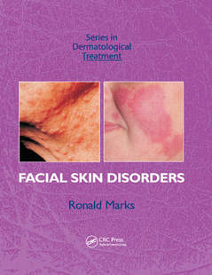 Skin Facial Disorders 预订