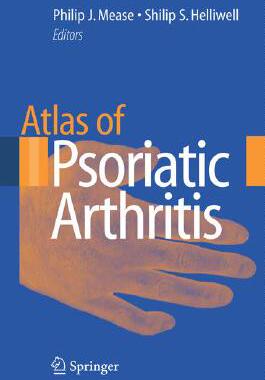 【预订】Atlas of Psoriatic Arthritis