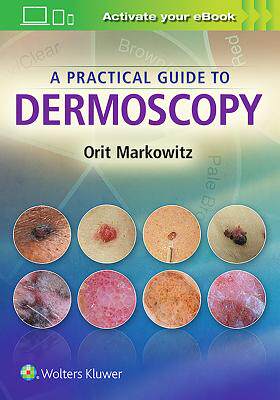 【预订】A Practical Guide to Dermoscopy