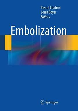 【预订】Embolization