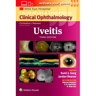 预订 Uveitis (Wills Eye Institute Atlas Series) 葡萄膜炎(Wills眼科研究所图谱系列): 9781975215194