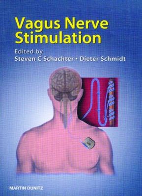 【预订】Vagus Nerve Stimulation, Second Edition
