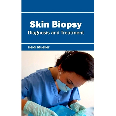 预订 Skin Biopsy: Diagnosis and Treatment 皮肤活检：诊断和*: 9781632423740