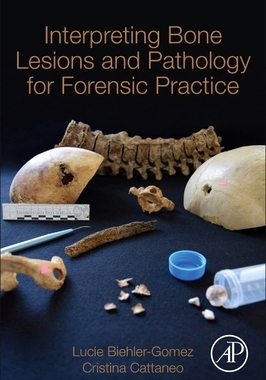 【预订】Interpreting Bone Lesions and Pathology for Forensic Practice