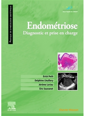 预订 Endométriose : diagnostic et prise en charge 子宫内膜异位症：诊断和*: 9782294767814