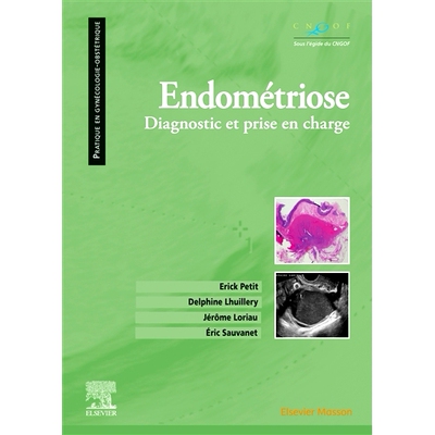 预订 Endométriose : diagnostic et prise en charge 子宫内膜异位症：诊断和*: 9782294767814