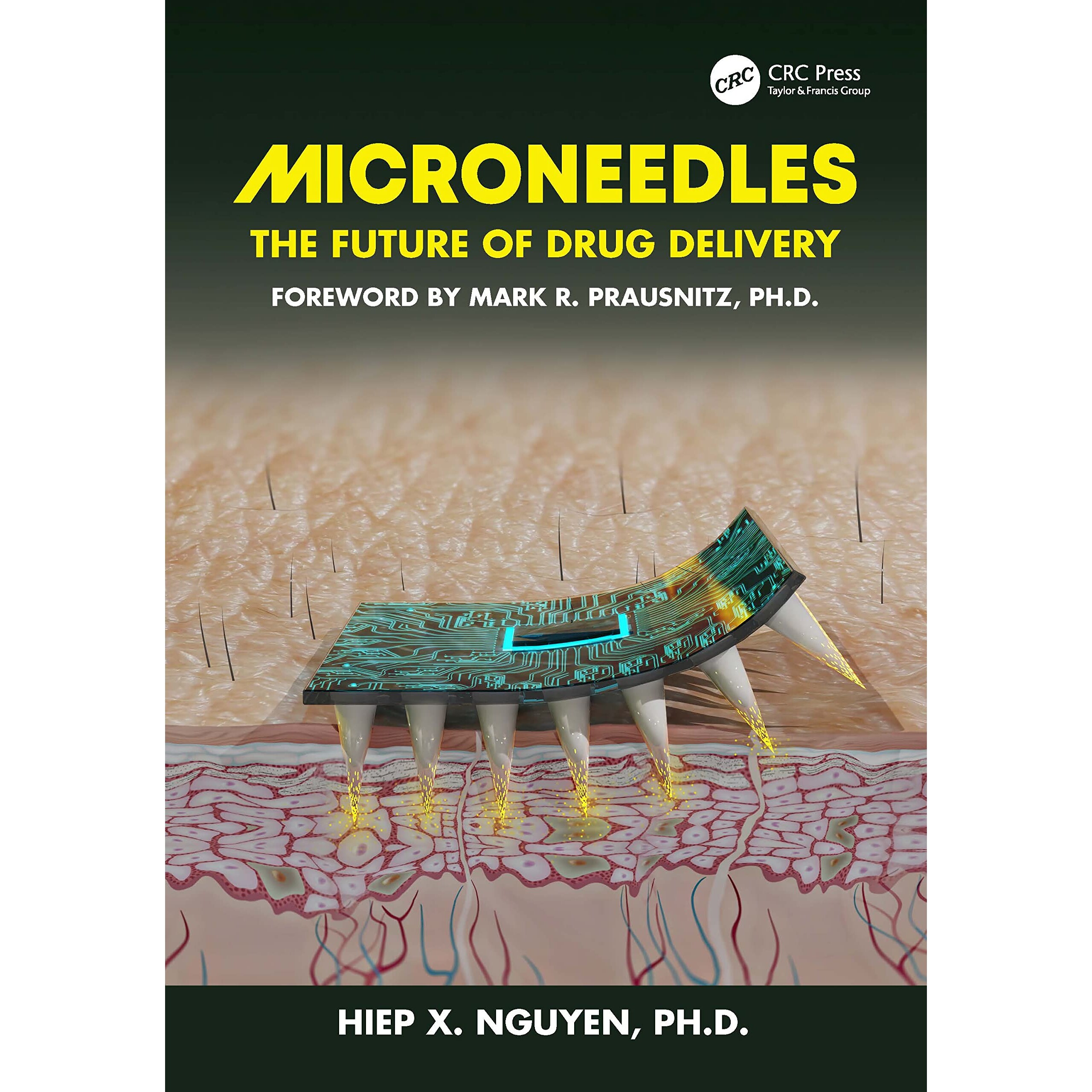 预订 Microneedles The Future of Drug Delivery 微针:*输送的未来 9781032514086