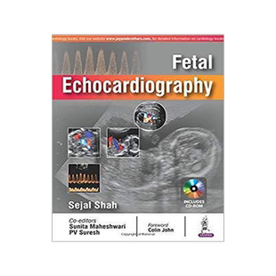 [预订]Fetal Echocardiography 9789352701100