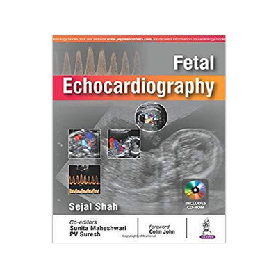[预订]Fetal Echocardiography 9789352701100
