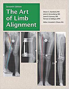 Limb Alignment Art 预售 The
