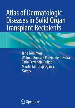 [预订]Atlas of Dermatologic Diseases in Solid Organ Transplant Recipients 9783031133374