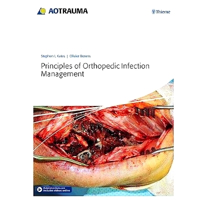 预订 Principles of Orthopedic Infection Management 骨科感染管理的原则: 9783132410756