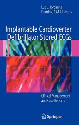 【预订】Implantable Cardioverter Defibrillator Stored ECGs
