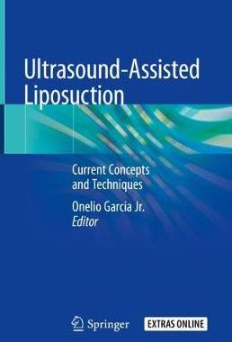 【预订】Ultrasound-Assisted Liposuction