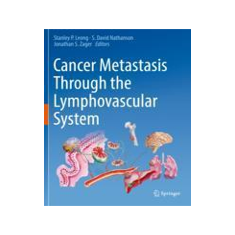 [预订]Cancer Metastasis Through the Lymphovascular System 9783030930868