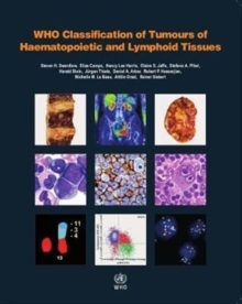 WHO Classification of Tumours of Haematopoietic and Lymphoid Tissues