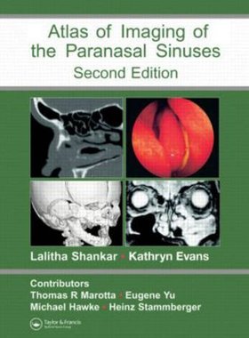 【预订】Atlas of Imaging of the Paranasal Sinuses, Second Edition