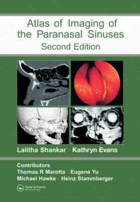 【预订】Atlas of Imaging of the Paranasal Sinuses, Second Edition