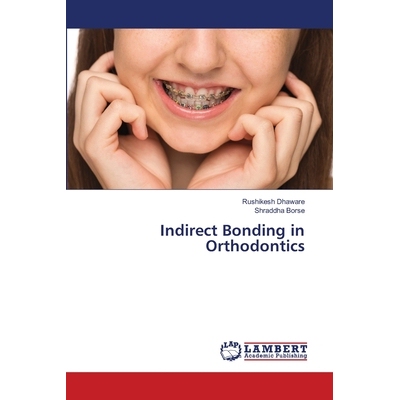 预订 Indirect Bonding in Orthodontics: 9786207453689