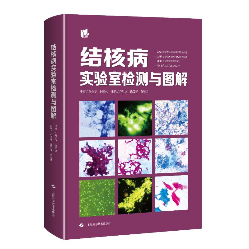 结核病实验室检测与图解  9787547853443