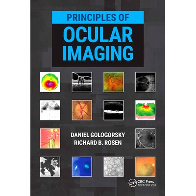 预订 Principles of Ocular Imaging 眼科影像学原理: 9781630915995