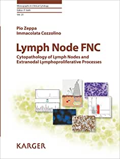【预售】Lymph Node FNC