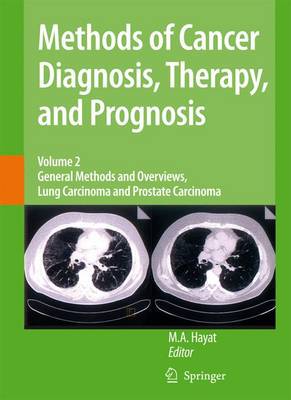 【预订】Methods of Cancer Diagnosis, Therapy and Prognosis