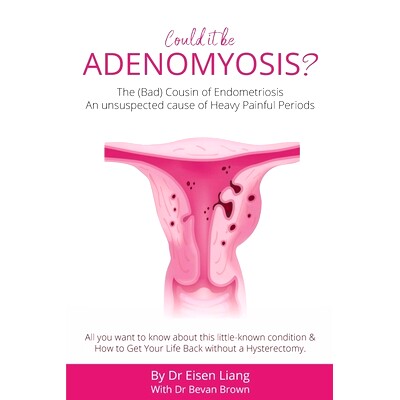 预订 Adenomyosis -The Bad Cousin of Endometriosis: An unsuspected cause of Heavy Painful Periods: 9781925471564