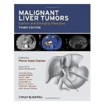 预订 Malignant Liver Tumors - Current and Emerging Therapies 3E 恶性肝脏肿瘤 第3版: 9781405179768
